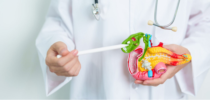Doctor holding a pancreas model to explain pancreatic damage in Type 3c diabetes